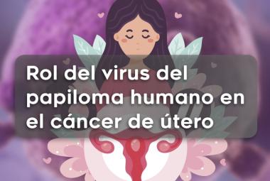 FLACSalud-Rol del virus del papiloma humano en el cáncer de útero